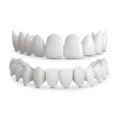 Shiny Smile Veneers Reviews2