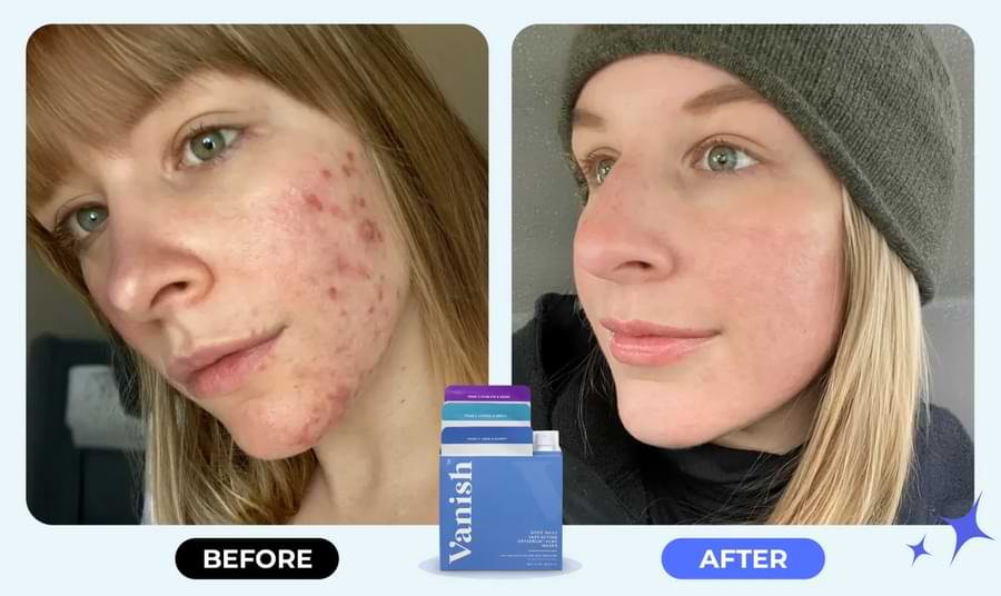 Vanish DrySerum Reviews2